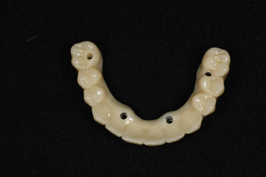 După 4