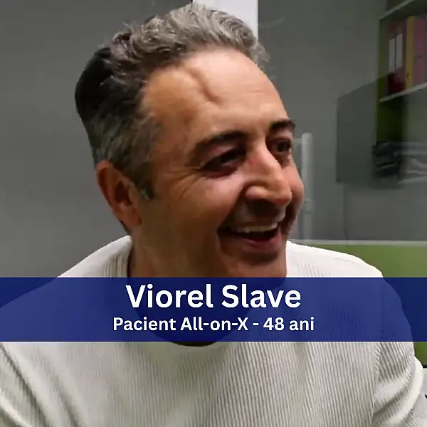 Rezultatul tratamentului lui Viorel Slave la DaviDent Aesthetics, Sector 6 București