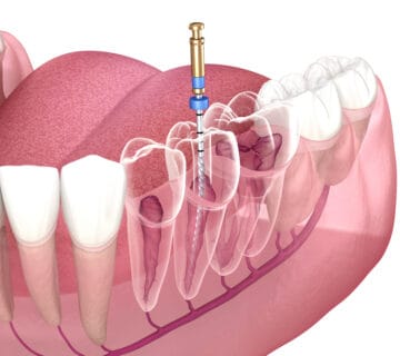 Echipa Davident în cadrul acestui cabinet stomatologic sector 6, oferind servicii complete de stomatologie sector 6  Suntem un dentist drumul taberei de încredere, activând într o clinica stomatologica sector 6 modernă  Vizitați ne la acest cabinet stomatologic drumul taberei pentru soluții oferite de un dentist sector 6 experimentat  Davident este o clinica dentara sector 6 și un cabinet stomatologic sector 6 drumul taberei dedicat sănătății tale prin servicii de stomatologie drumul taberei la standarde înalte 