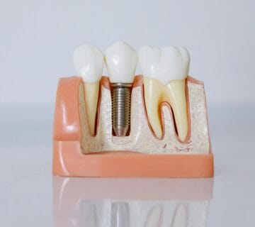 Echipa Davident în cadrul acestui cabinet stomatologic sector 6, oferind servicii complete de stomatologie sector 6  Suntem un dentist drumul taberei de încredere, activând într o clinica stomatologica sector 6 modernă  Vizitați ne la acest cabinet stomatologic drumul taberei pentru soluții oferite de un dentist sector 6 experimentat  Davident este o clinica dentara sector 6 și un cabinet stomatologic sector 6 drumul taberei dedicat sănătății tale prin servicii de stomatologie drumul taberei la standarde înalte 