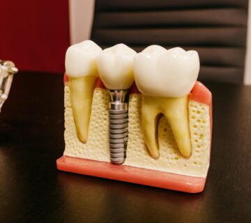 Echipa Davident în cadrul acestui cabinet stomatologic sector 6, oferind servicii complete de stomatologie sector 6  Suntem un dentist drumul taberei de încredere, activând într o clinica stomatologica sector 6 modernă  Vizitați ne la acest cabinet stomatologic drumul taberei pentru soluții oferite de un dentist sector 6 experimentat  Davident este o clinica dentara sector 6 și un cabinet stomatologic sector 6 drumul taberei dedicat sănătății tale prin servicii de stomatologie drumul taberei la standarde înalte 