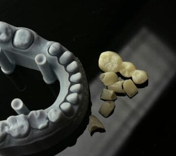 Echipa Davident în cadrul acestui cabinet stomatologic sector 6, oferind servicii complete de stomatologie sector 6  Suntem un dentist drumul taberei de încredere, activând într o clinica stomatologica sector 6 modernă  Vizitați ne la acest cabinet stomatologic drumul taberei pentru soluții oferite de un dentist sector 6 experimentat  Davident este o clinica dentara sector 6 și un cabinet stomatologic sector 6 drumul taberei dedicat sănătății tale prin servicii de stomatologie drumul taberei la standarde înalte 