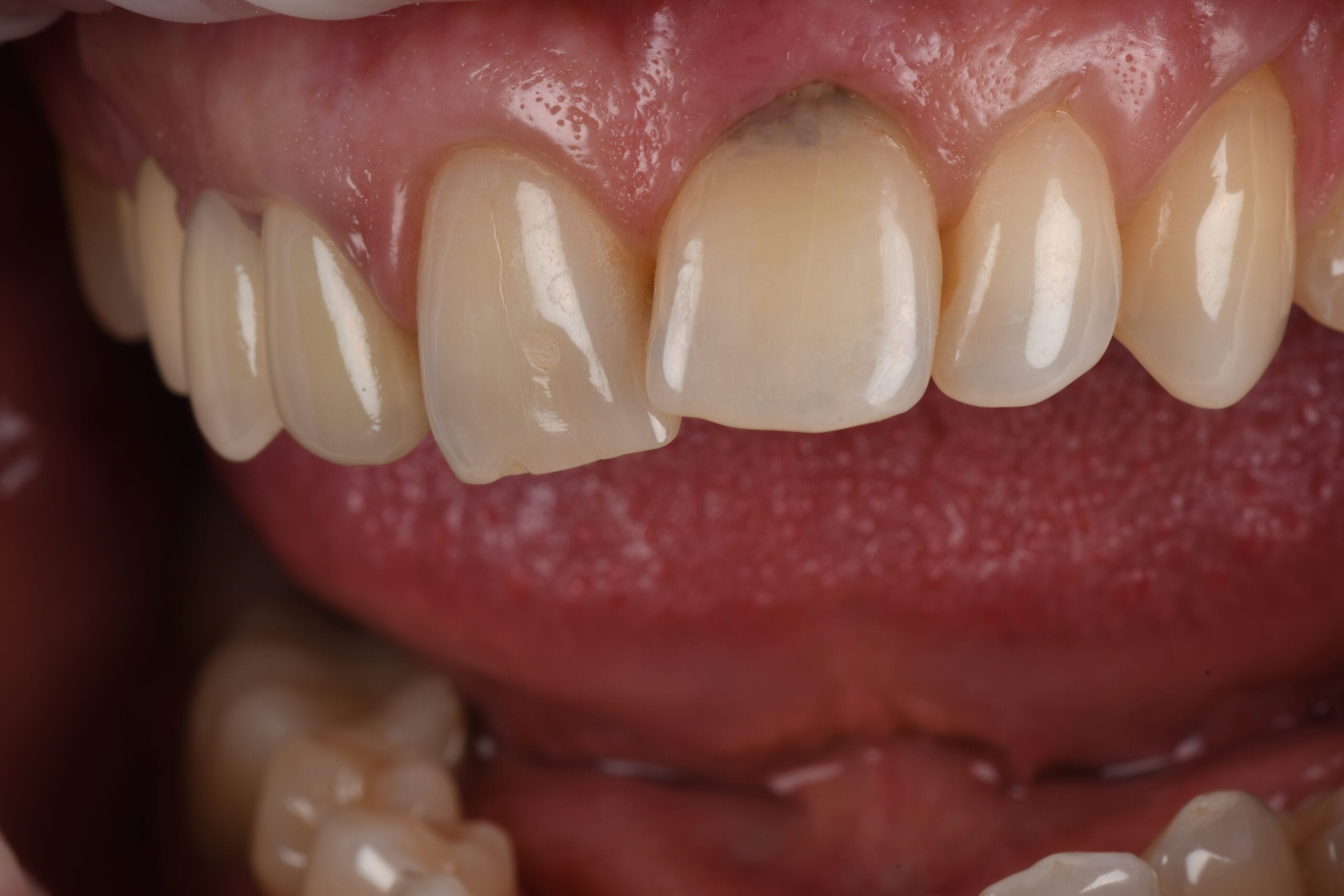 Echipa Davident în cadrul acestui cabinet stomatologic sector 6, oferind servicii complete de stomatologie sector 6  Suntem un dentist drumul taberei de încredere, activând într o clinica stomatologica sector 6 modernă  Vizitați ne la acest cabinet stomatologic drumul taberei pentru soluții oferite de un dentist sector 6 experimentat  Davident este o clinica dentara sector 6 și un cabinet stomatologic sector 6 drumul taberei dedicat sănătății tale prin servicii de stomatologie drumul taberei la standarde înalte 