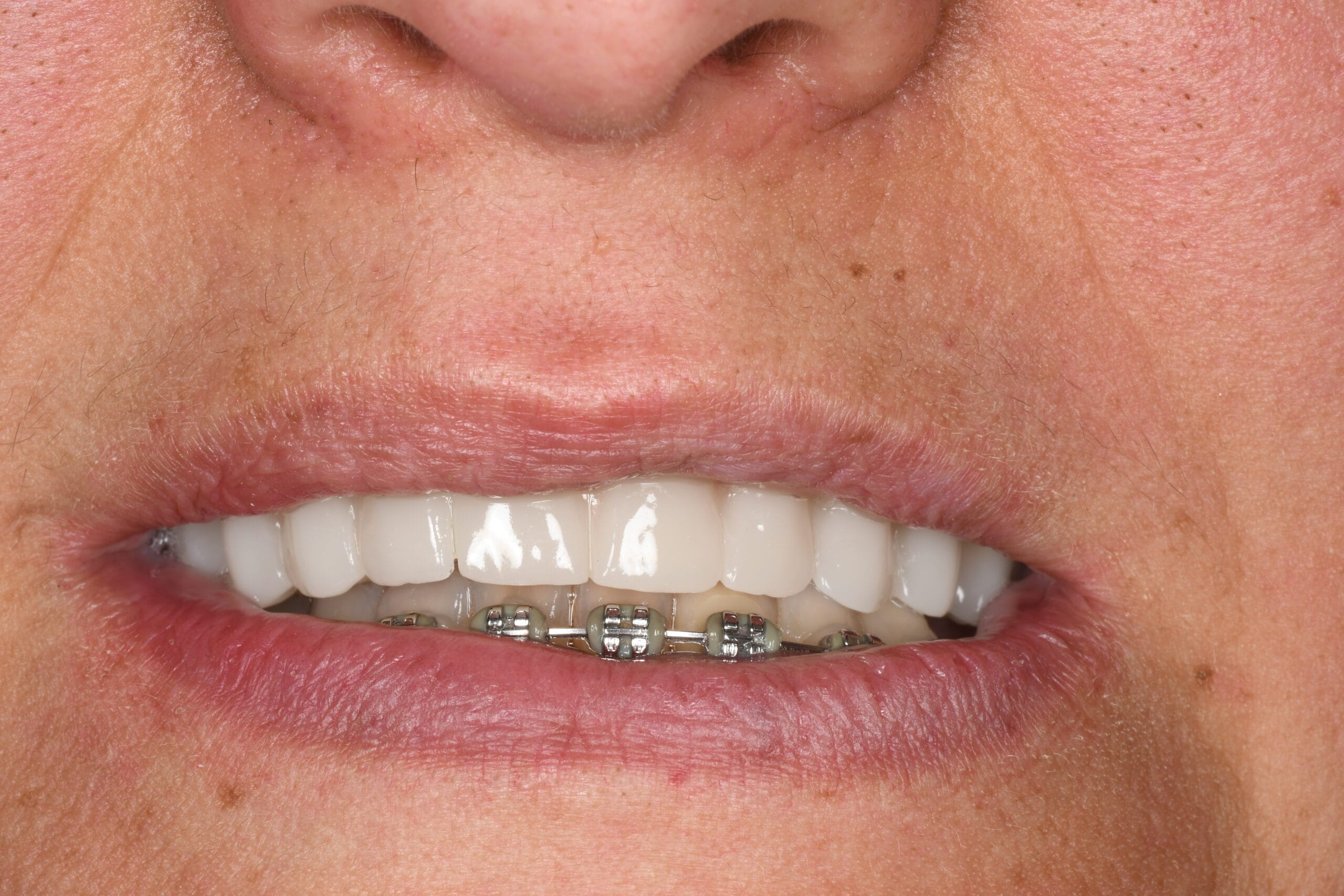 Echipa Davident în cadrul acestui cabinet stomatologic sector 6, oferind servicii complete de stomatologie sector 6  Suntem un dentist drumul taberei de încredere, activând într o clinica stomatologica sector 6 modernă  Vizitați ne la acest cabinet stomatologic drumul taberei pentru soluții oferite de un dentist sector 6 experimentat  Davident este o clinica dentara sector 6 și un cabinet stomatologic sector 6 drumul taberei dedicat sănătății tale prin servicii de stomatologie drumul taberei la standarde înalte 