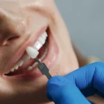 Echipa Davident în cadrul acestui cabinet stomatologic sector 6, oferind servicii complete de stomatologie sector 6  Suntem un dentist drumul taberei de încredere, activând într o clinica stomatologica sector 6 modernă  Vizitați ne la acest cabinet stomatologic drumul taberei pentru soluții oferite de un dentist sector 6 experimentat  Davident este o clinica dentara sector 6 și un cabinet stomatologic sector 6 drumul taberei dedicat sănătății tale prin servicii de stomatologie drumul taberei la standarde înalte 