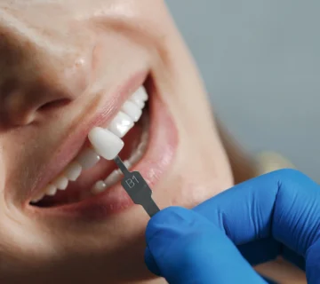 Echipa Davident în cadrul acestui cabinet stomatologic sector 6, oferind servicii complete de stomatologie sector 6  Suntem un dentist drumul taberei de încredere, activând într o clinica stomatologica sector 6 modernă  Vizitați ne la acest cabinet stomatologic drumul taberei pentru soluții oferite de un dentist sector 6 experimentat  Davident este o clinica dentara sector 6 și un cabinet stomatologic sector 6 drumul taberei dedicat sănătății tale prin servicii de stomatologie drumul taberei la standarde înalte 